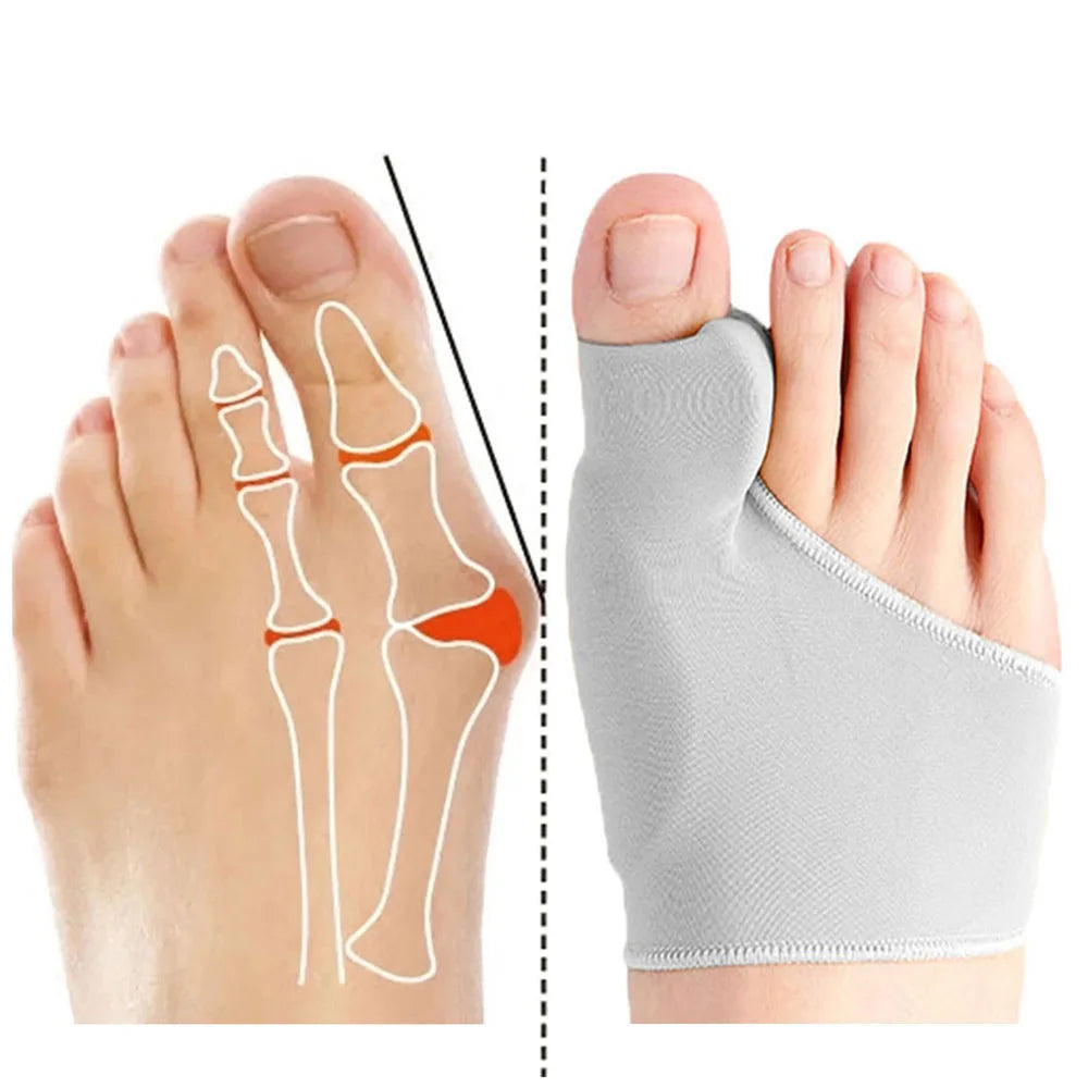 Toe Separator Hallux Valgus Bunion Corrector Orthotics Feet Bone Thumb Adjuster Correction Pedicure Sock Straightener Foot Care